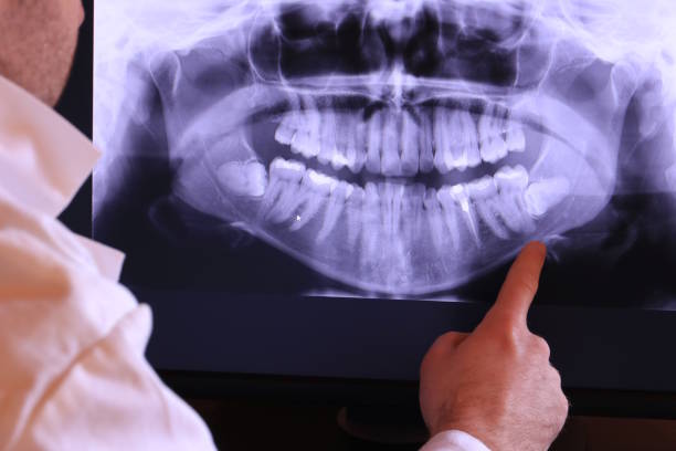 Best Chipped Tooth Repair Near Me  in Lester Prairie, MN